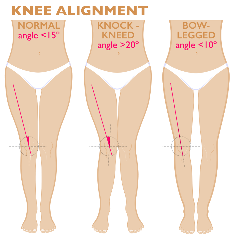 Knee Alignment